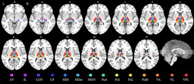 More Than Just Static: Dynamic Functional Connectivity Changes of the <mark class="highlighted">Thalamic Nuclei</mark> to Cortex in Parkinson's Disease With Freezing of Gait